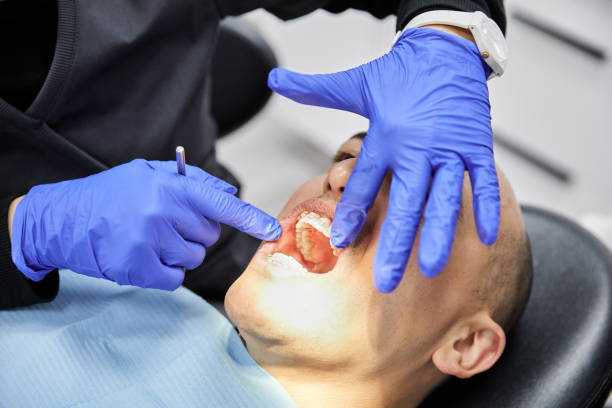 Best Cracked Tooth Emergency Dentist  in Buffalo, OK