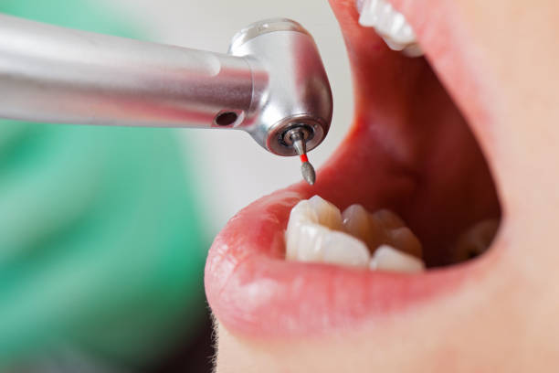 Best Knocked-Out Tooth Emergency  in Buffalo, OK